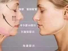 曹正東——面部線雕與小切口除皺應該如何選擇？