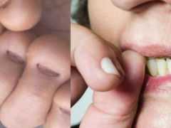 專家透露：經常咬指甲的人，基本都源於這3種“本能反應”