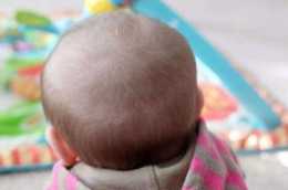 寶寶剛出生胎髮烏黑濃密，為何長著長著就又黃又細又稀？
