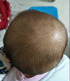 【眾道妙方】寶寶頭上長出幾根白頭髮？原來是缺乏微量元素