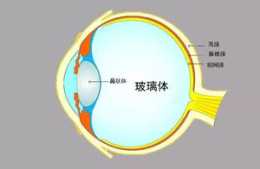 高度近視患者的視網膜是如何脫離的？