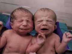 95後孕婦生下兩個孩子，本以為生下雙胞胎，醫生卻搖頭：並不是